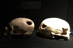 Lima -Archäologisches Museum - Schädel